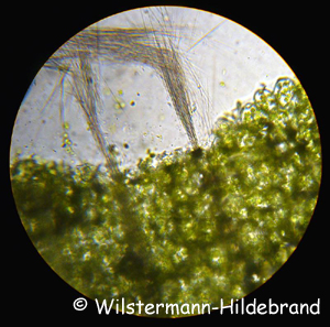 Austretende Calciumoxalat-Nadeln aus einem gequetschten Wasserkelchblatt