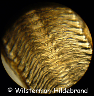 Mikroskopische Aufnahme einer Apfelschnecken-Radula
